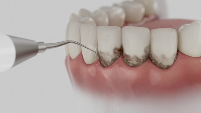Trusted Root Canal Treatment service in Warrenville, IL - Dentist Open Now